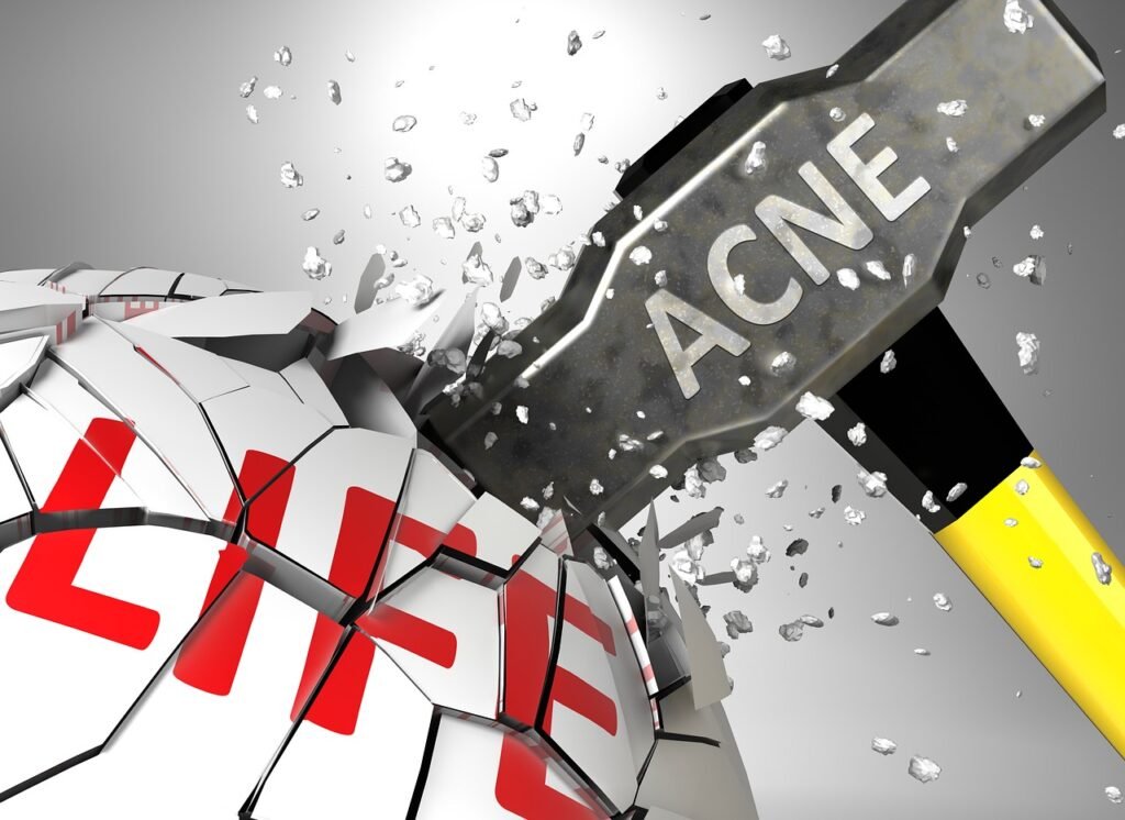 Acnes White