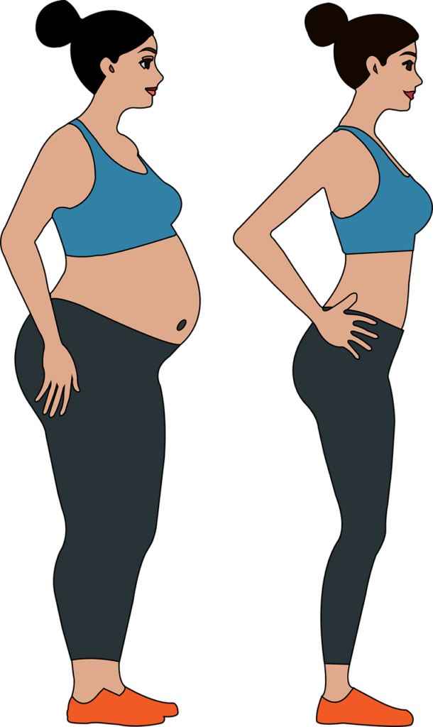 Gastric Sleeve Weight Loss Before and After
