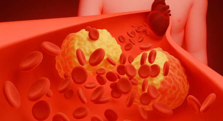 Can Ozempic Cause Blood Clots